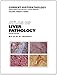 Atlas of Liver Pathology