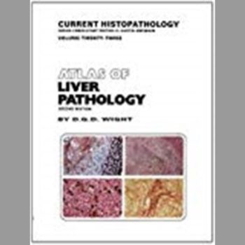 Atlas of Liver Pathology