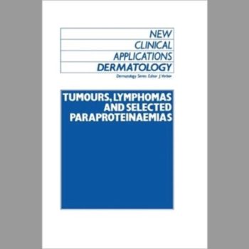 Tumours Lymphomas and Selected Paraproteinaemias